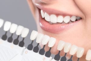 teeth whitening annapolis