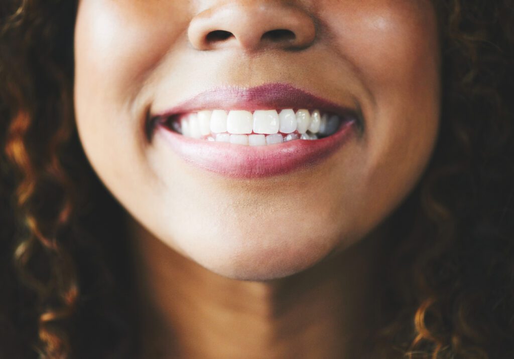 Professional TEETH WHITENING in Davidsonville MD is a safe and effective way to improve your smile